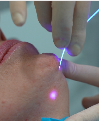 Papadaendoliftifacial-reafirmante-jpg