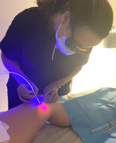 endolifting-corporal-san-vicente-del-raspeig-alicante.jpg Endolifting corporal en piernas para mejorar la firmeza de la piel y reducir grasa localizada.